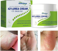 South Moon 42% Urea Cream with 2% Salicylic Acid, moisturizing skincare treatment in a jar, suitable for dry and rough skin.