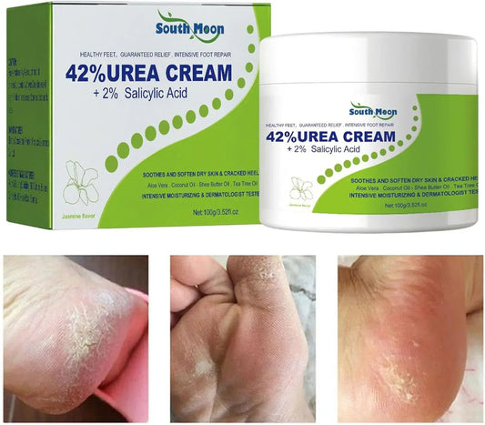 South Moon 42% Urea Cream with 2% Salicylic Acid, moisturizing skincare treatment in a jar, suitable for dry and rough skin.